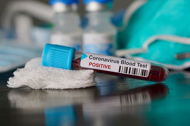 COVID-19 cases tally reaches 992 with one new patient