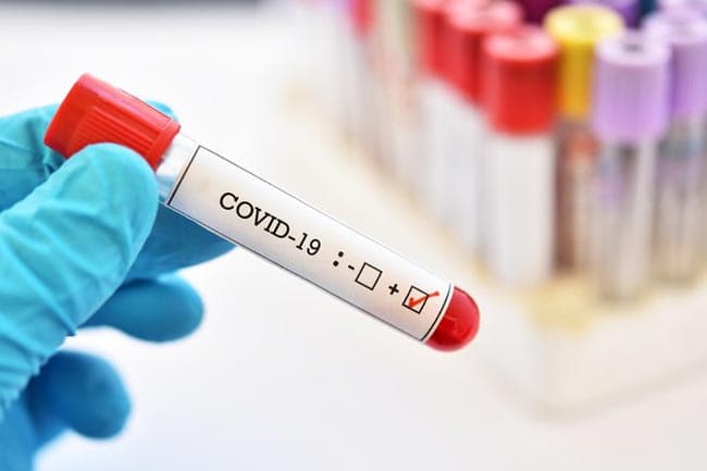 COVID-19: Two new cases bring total count to 1,030