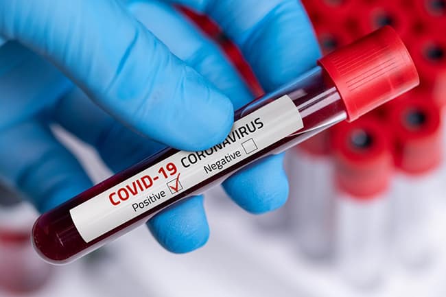 COVID-19: Cases reach 1,118 as Indonesia returnee tests positive