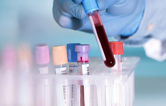 Fourteen more COVID-19 cases move total to 1,162