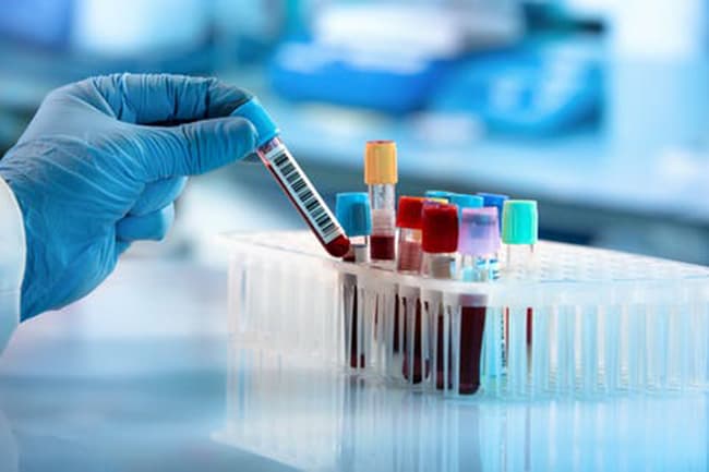 Total count rises to 1,548 with eight fresh COVID-19 cases