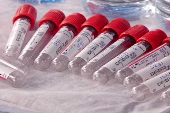No infections detected at Gaffoor Building and surroundings