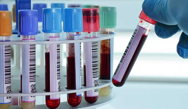 Thirty more Covid-19 cases reported as total hits 1,683