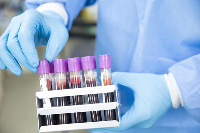 Coronavirus patient tally moves up to 1,735 with five fresh cases