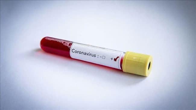Seven more Covid-19 cases brings total to 1,797