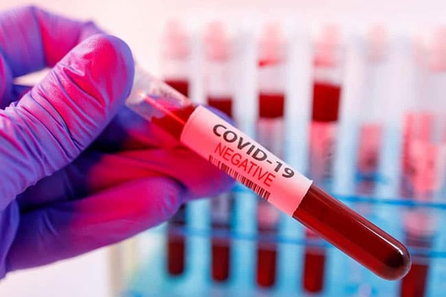 Coronavirus recoveries reported in Sri Lanka reach 858