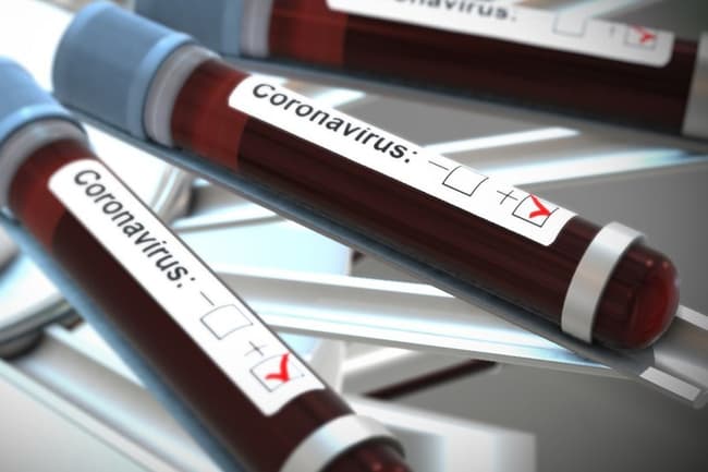 Three new COVID-19 patients add up 1,800 total cases