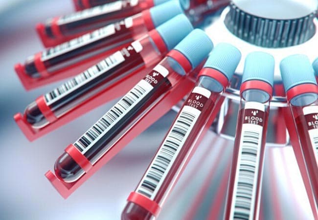 More cases bring coronavirus count to 1,857