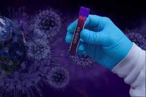Two more Covid-19 cases increases total to 1,863