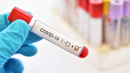 Four new cases of Covid-19 brings total to 1,873