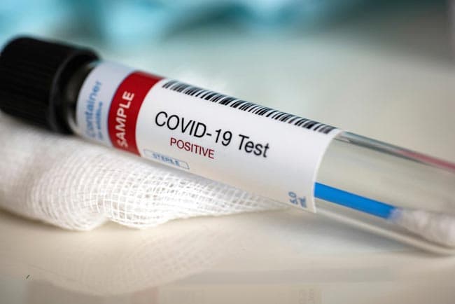 Woman recovered from COVID-19 contracts virus again
