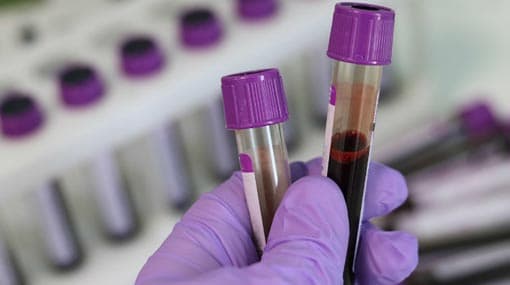 Six more test positive for COVID-19; tally at 1,921