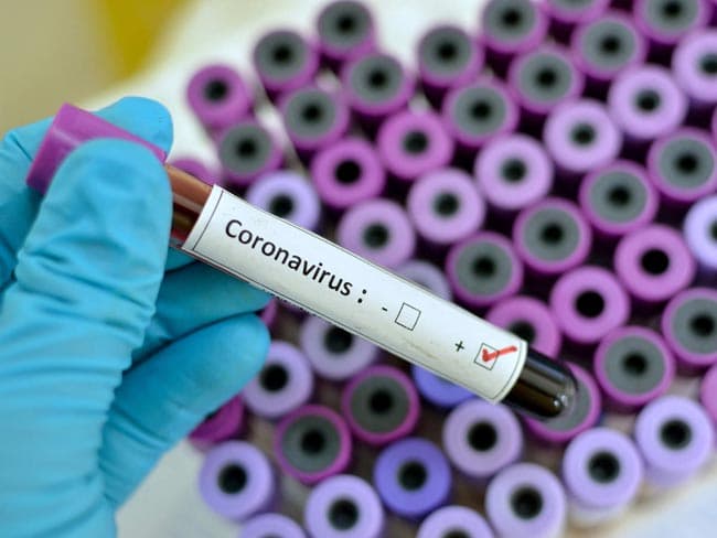 Coronavirus count in Sri Lanka moves to 2,034