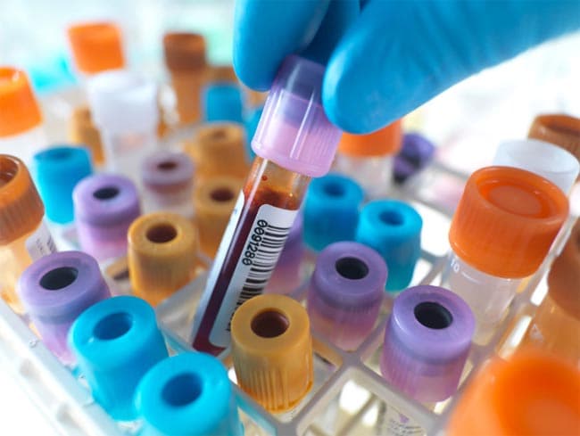 Five arrivals from Oman add to coronavirus case tally
