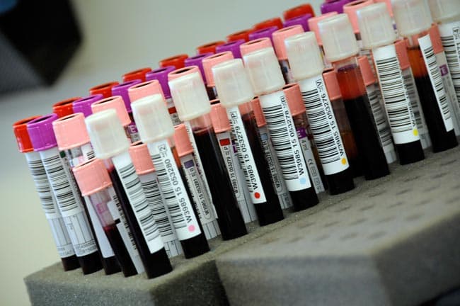 Coronavirus: 90 new positive cases identified