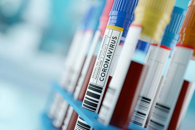 Two more COVID-19 patients add to case tally