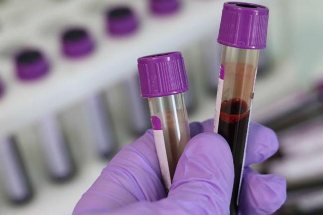 COVID-19: Two fresh cases from Rajanganaya and Lankapura