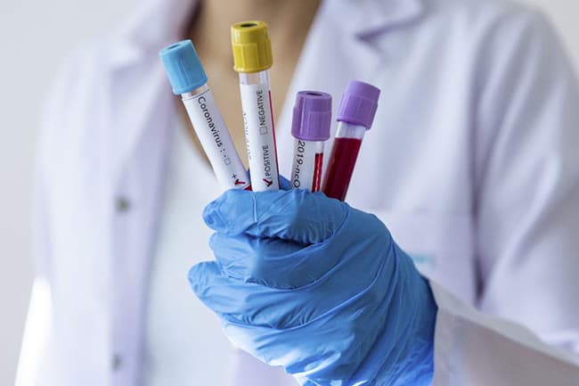COVID-19 infections in Sri Lanka rise to 2,661