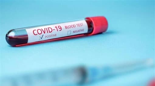 Covid-19 tally rises to 2,728 with four more cases