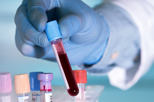 Relative of COVID-19 case from Lankapura DS tests positive