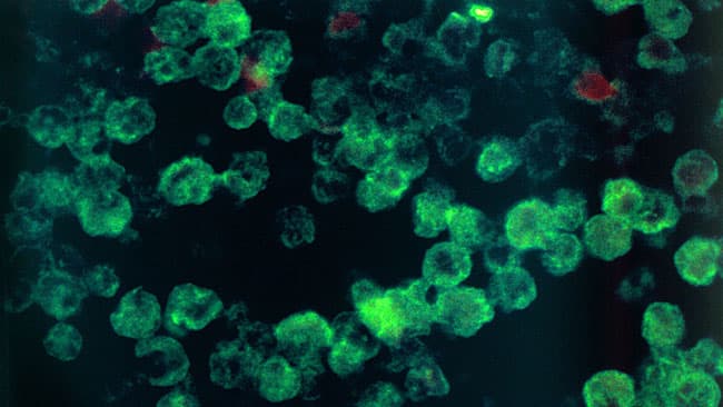US: Texas city warned over brain-eating microbe in water supply