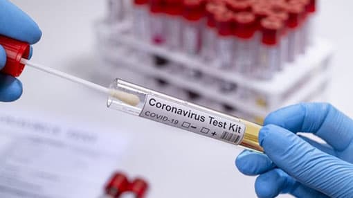 Five new cases of Covid-19 reported