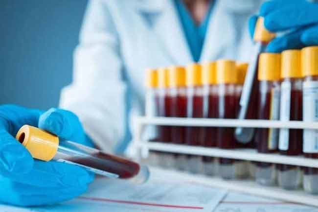 49 more cases add to Minuwangoda COVID-19 cluster