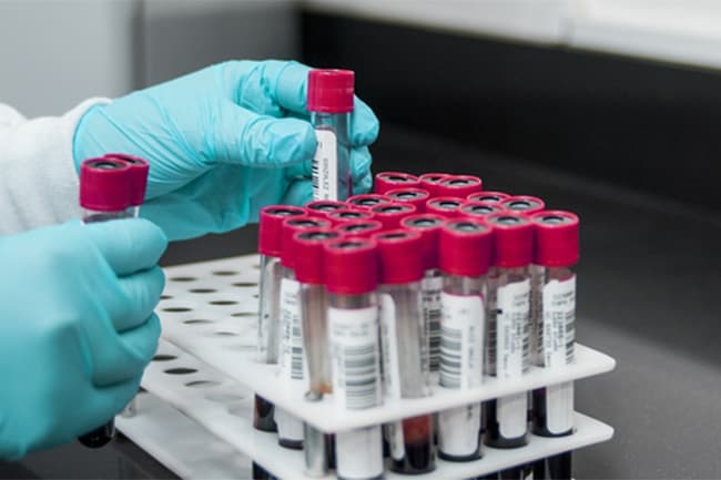 Minuwangoda Covid-19 cluster expands with 49 fresh cases