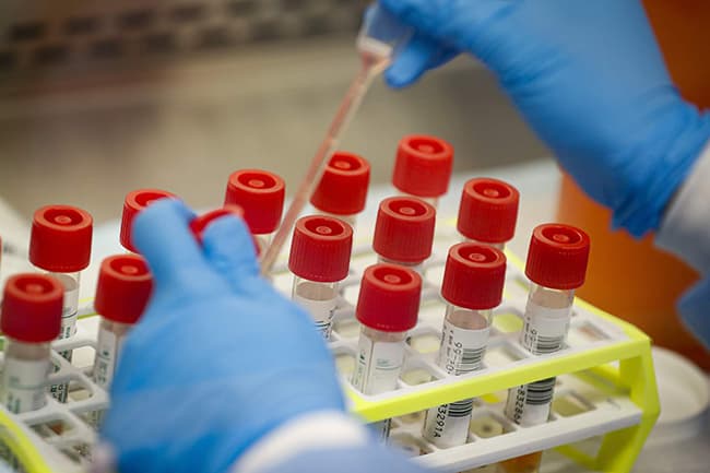 COVID-19 infections soar as 120 more test positive