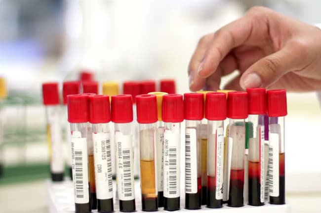 Sri Lanka’s Covid-19 caseload surpasses 43,000