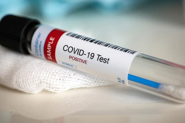 Several employees of a state ministry contact Covid-19
