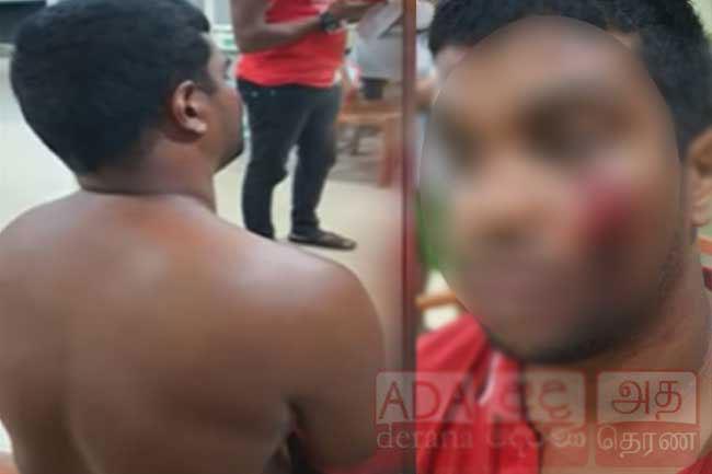 Court orders removal of Peliyagoda Police from investigations into assault on law student
