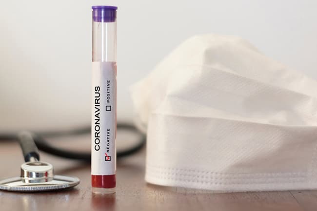 Coronavirus: 161 more patients discharged upon recovery