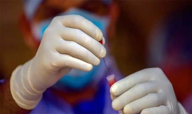 Sri Lanka reports 260 fresh cases of COVID-19