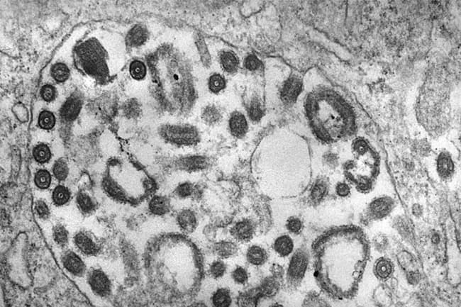 CDC issues warning about deadly Marburg virus amid outbreaks in Africa