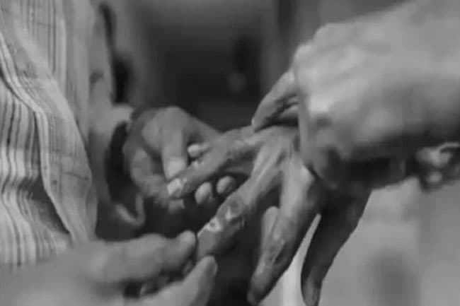 Health authorities decide not to conduct Leprosy tests associated with schools