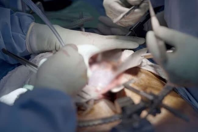 Kidney trafficking racket: Court dismisses request by accused doctors to lift travel ban
