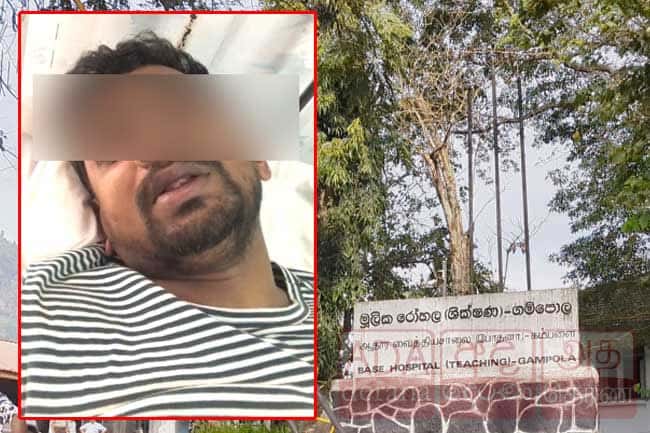 Chairman of Ganga Ihala Korale PS accused of assaulting businessman