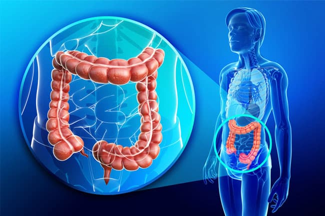 Alarming surge in colon and rectal cancers among 30–50 age group in Sri Lanka: Health authorities