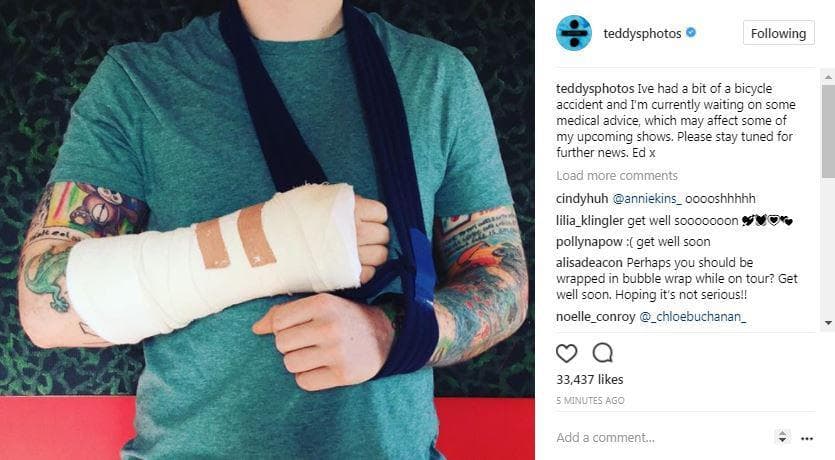 Ed Sheeran breaks arm in cycling accident