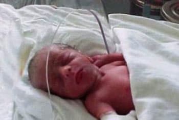 Another infant death at Mahamodara Hospital