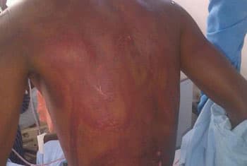 Students abducted, assaulted and freed in Puttalam
