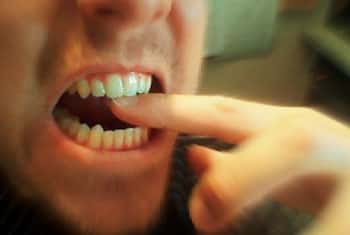 Man bites roommate’s finger during argument