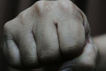 UNP supporter hospitalized after assault