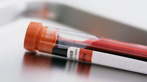 Investigation launched as unidentified man obtains blood sample from student
