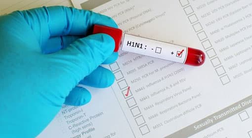 37 H1N1 cases reported in Kilinochchi within 21 days - reporter