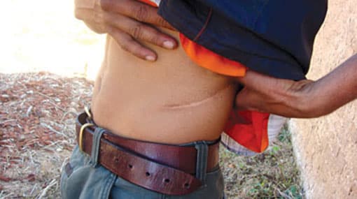 Sri Lankan refugees are selling organs to get to Australia?