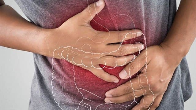 Rise in intestinal disorders among Sri Lankan youth linked to changing diets, Specialist warns