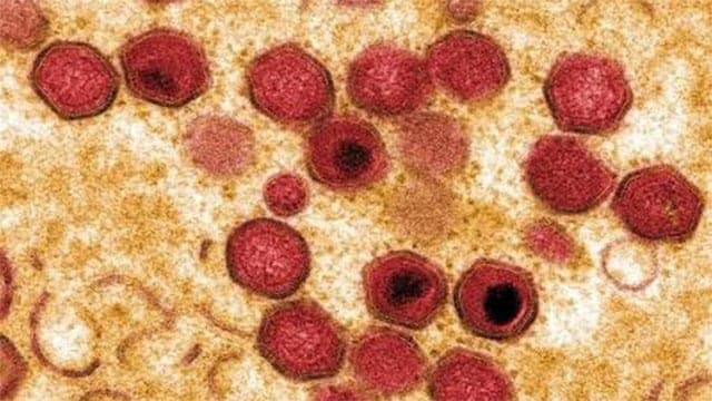 African Swine Fever resurfaces at farms in six districts